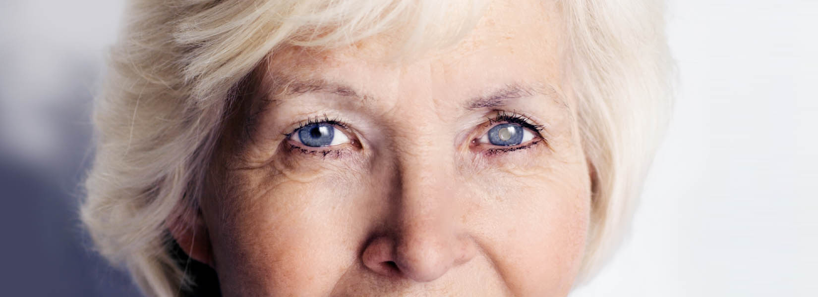 Cataract Surgery in Camdenton
