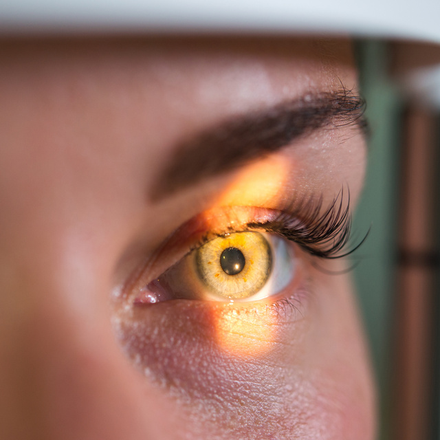 Vision Therapy in Camdenton